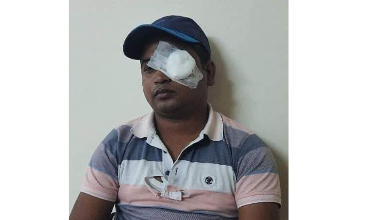 অবৈধ বিদ্যুৎ সংযোগ বিচ্ছিন্ন করতে গিয়ে দিরাই বিদ্যুৎ সরবরাহের উপ-সহকারী প্রকৌশলী আল ইমরান হামলার শিকার